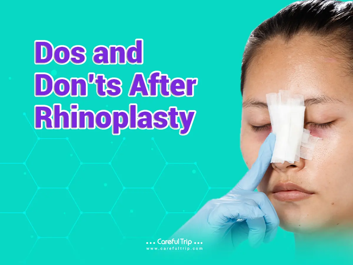 Dos and don’ts after Rhinoplasty