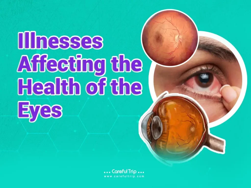 Illnesses affecting the health of the eyes