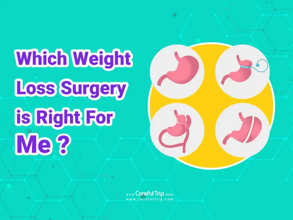 Weight Loss Surgery: A Comprehensive Guide to Sustainable Transformation