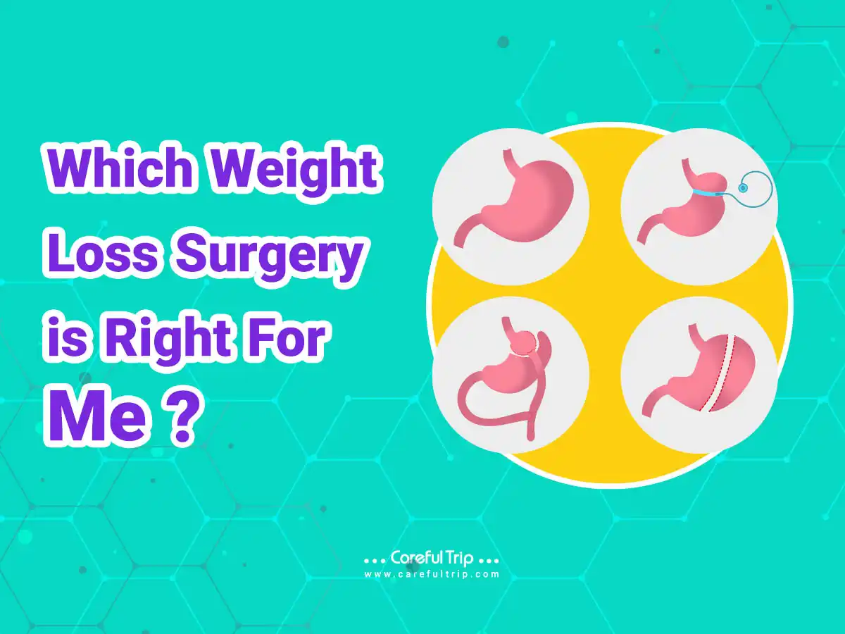 Which weight loss surgery is right for me?