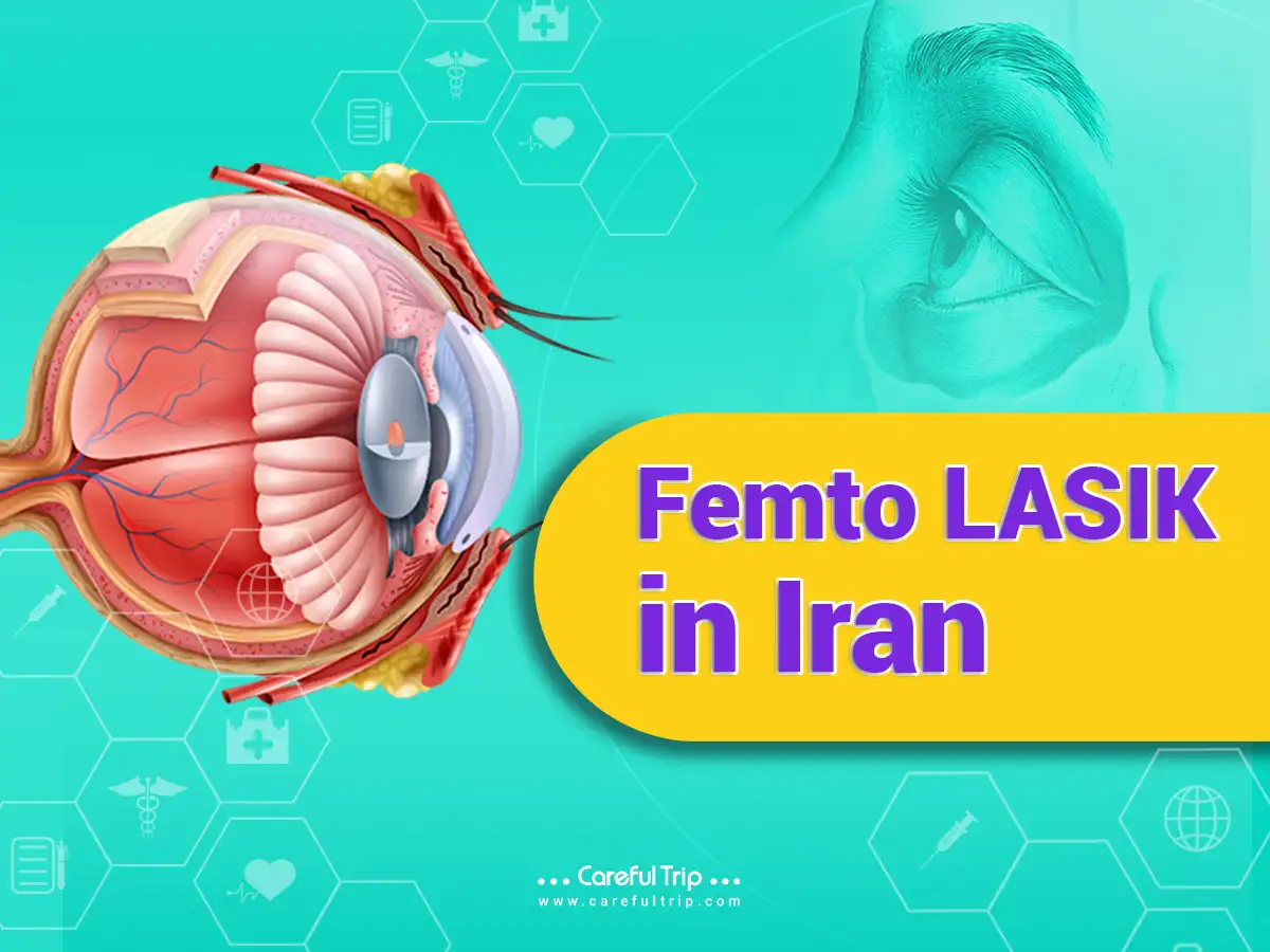 Femto LASIK in Iran