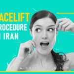 Facelift Procedure in Iran
