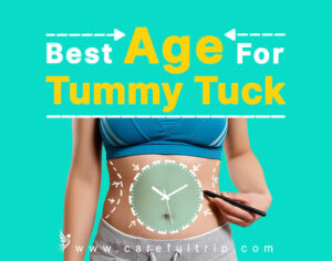 What is the best age for tummy tuck?