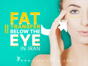 Fat transfer below the eye