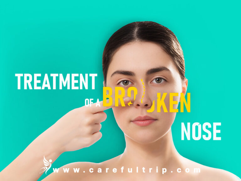 Treatment Of A Broken Nose CarefulTrip