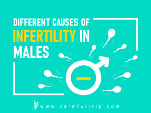 Different Causes of Infertility in Males