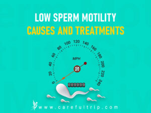 Low Sperm Motility: Causes and Treatments