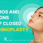 Pros and Cons of Closed Rhinoplasty