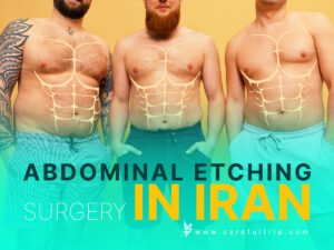 Abdominal Etching Surgery in Iran