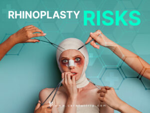 Rhinoplasty Risks