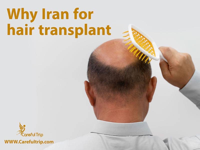Why Iran for hair transplant?