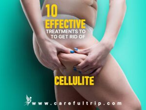 10 Effective Treatments to Get Rid Of Cellulite