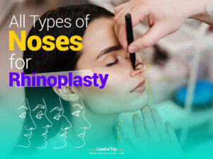 All Types of Noses for Rhinoplasty