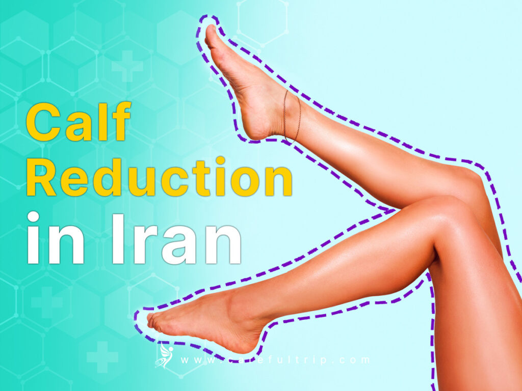 Calf Reduction in Iran