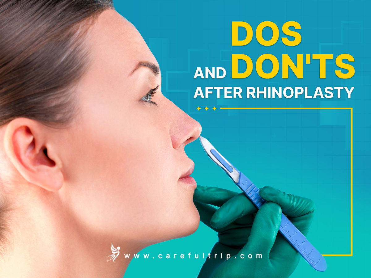 Dos and don’ts after Rhinoplasty