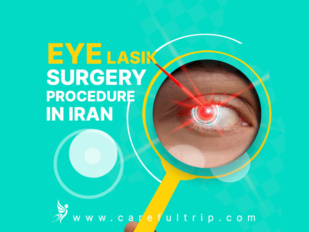 Eye Lasik surgery procedure in Iran