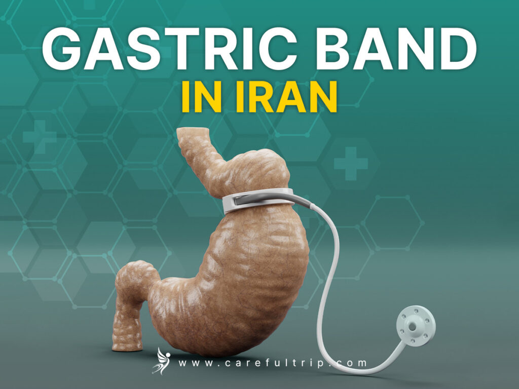 Gastric Band in Iran