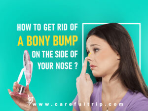 How To Get Rid of A Bony Bump On The Side Of Your Nose?