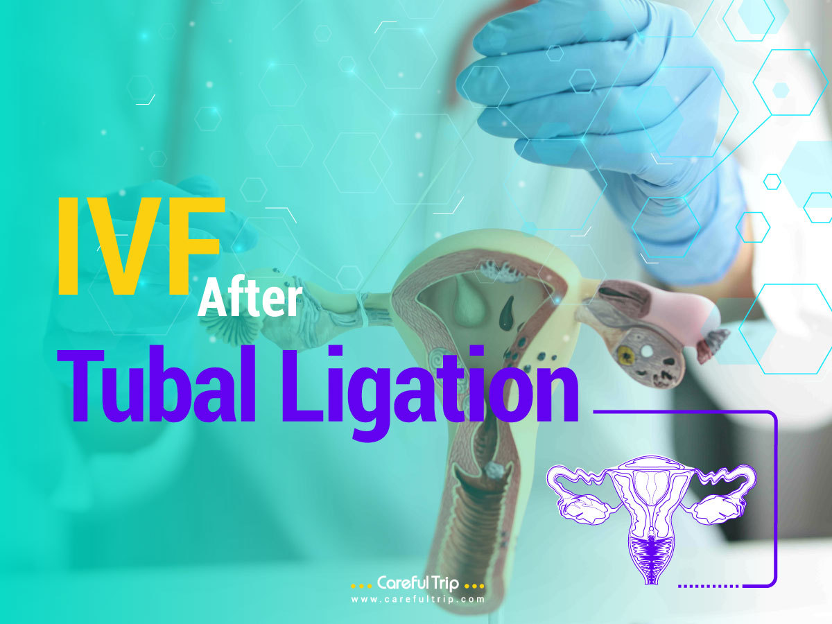 IVF After Tubal Ligation