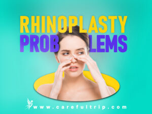8 Frequent Rhinoplasty Problems