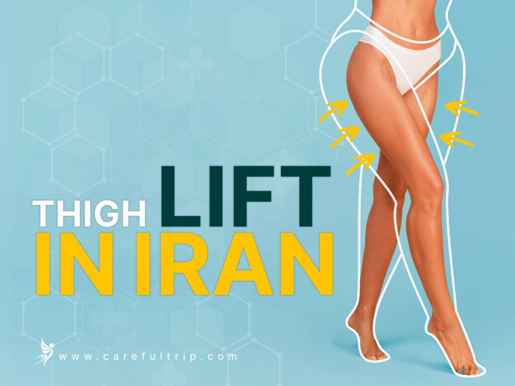 Thigh Lift in Iran