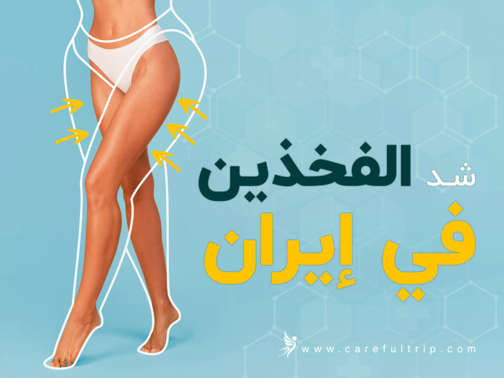 شد الفخذين في إيران