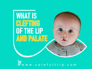 What is clefting of the lip and palate?