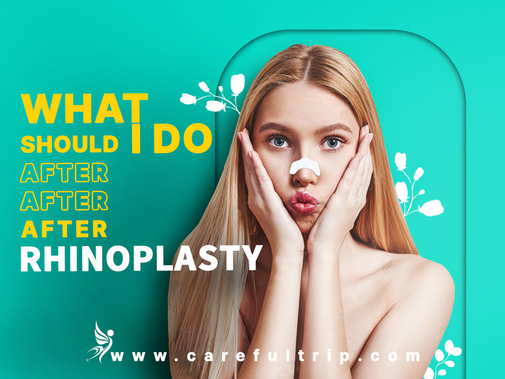 What should I do after rhinoplasty?