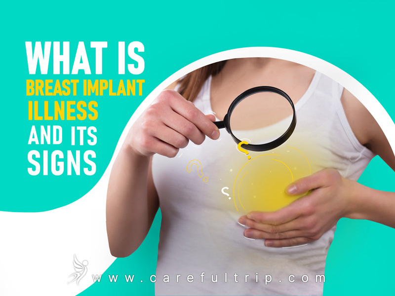 What is Breast Implant Illness and Its Signs?