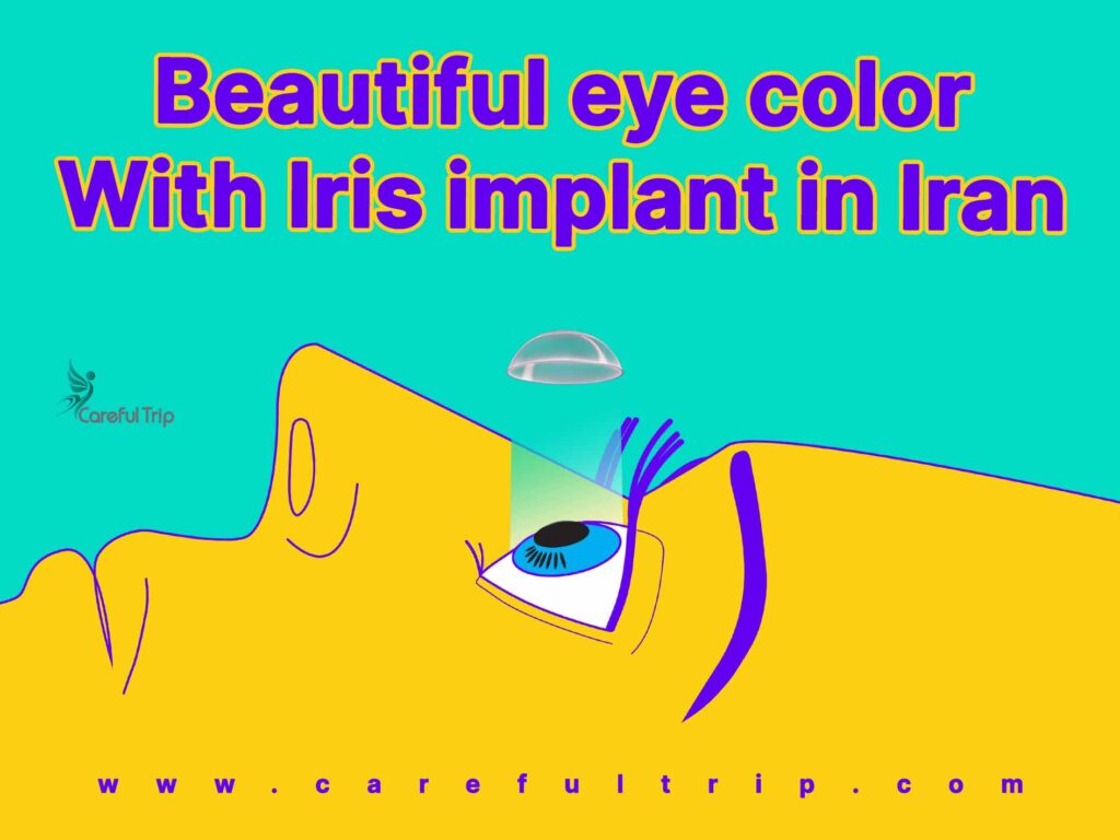 beautiful eye color with iris implant in iran 11644298504