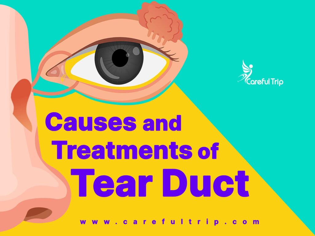 Causes and Treatments of Tear Duct