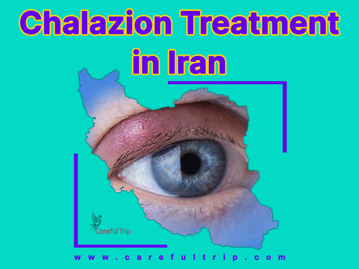 Chalazion treatment in Iran in 2024
