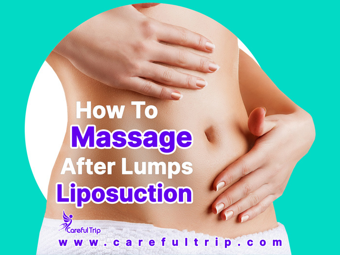 Lumps After Liposuction