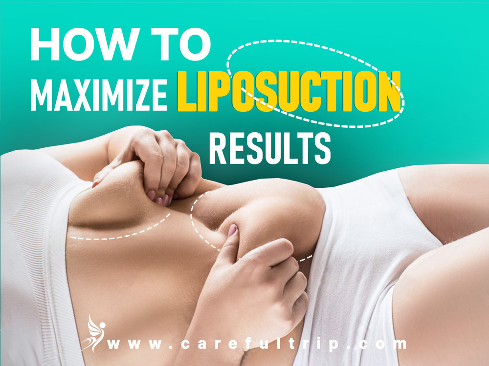 How To Maximize Liposuction Results?