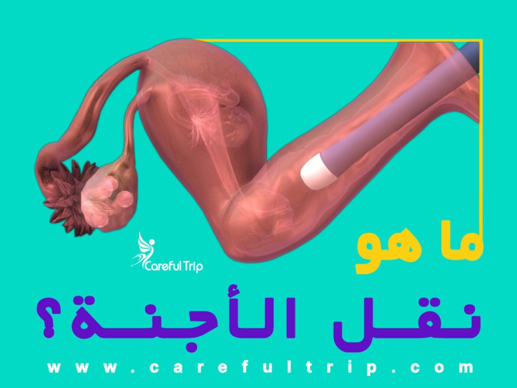 ما هو نقل الأجنة؟