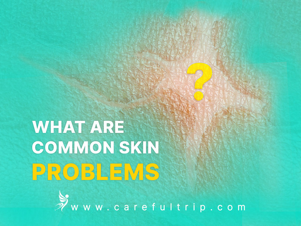 What are common skin problems?