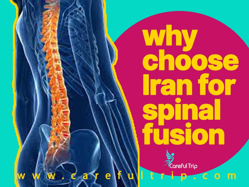 why choose Iran for spinal fusion