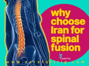 why choose Iran for spinal fusion