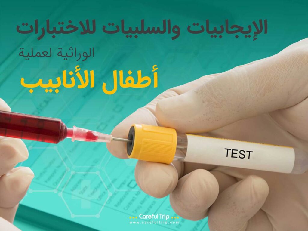 الإيجابيات والسلبيات للاختبارات الوراثية لعملية أطفال الأنابيب