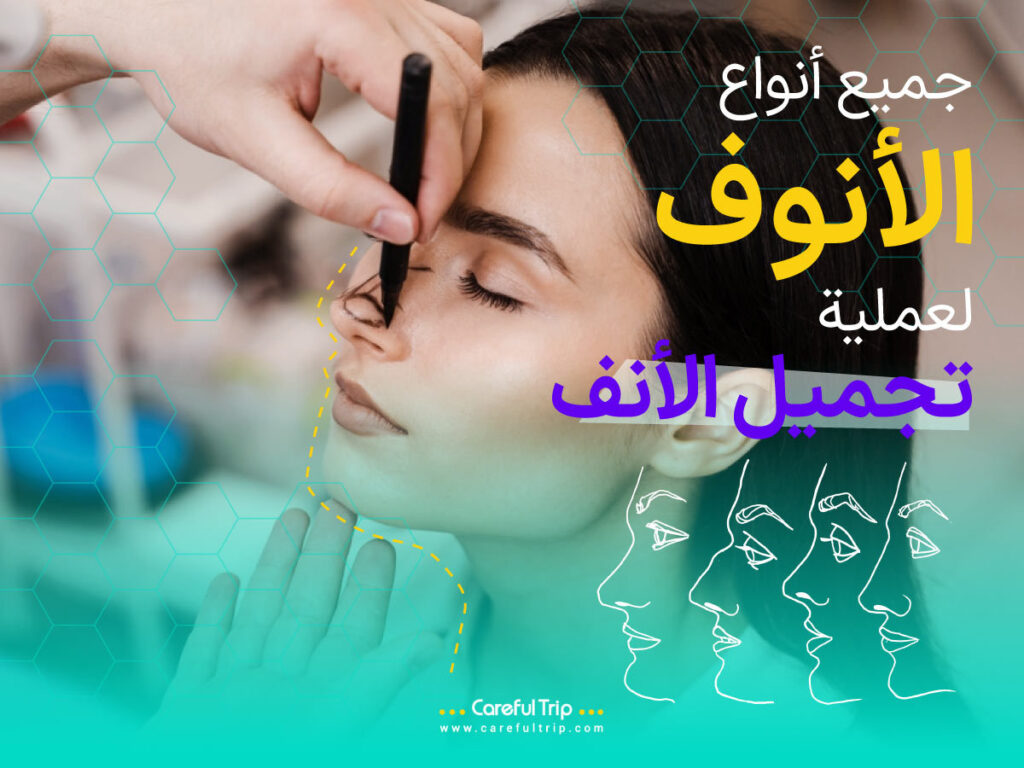 جميع أنواع الأنف لعملية تجميل الأنف