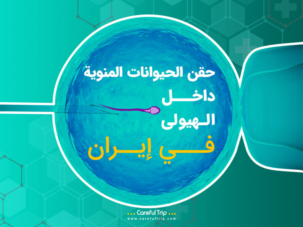 حقن الحيوانات المنوية داخل الهيولى في إيران