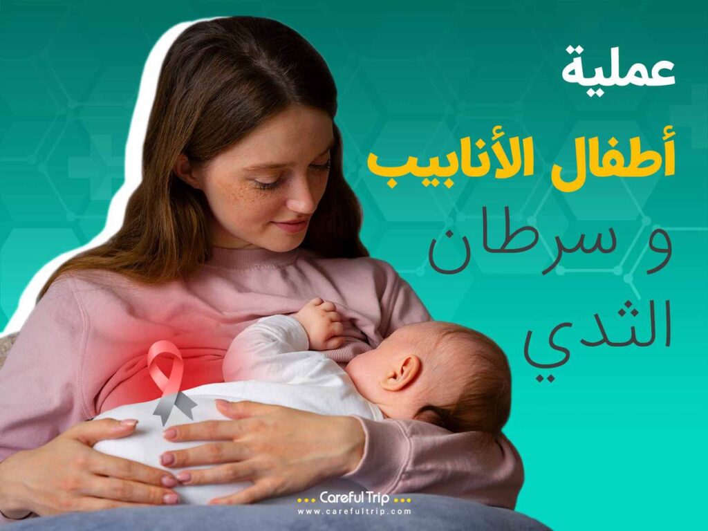 عملية أطفال الأنابيب وسرطان الثدي