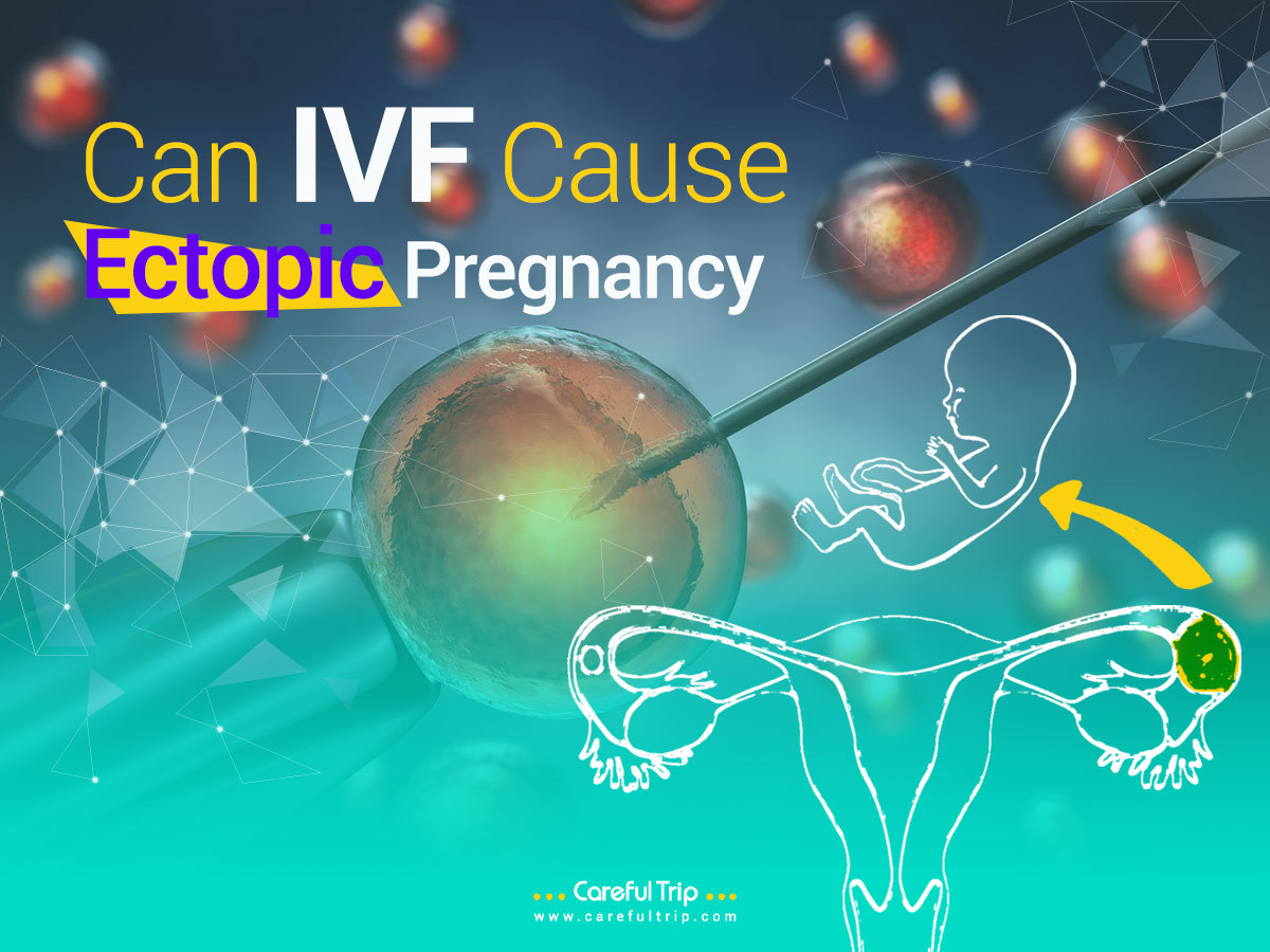 Can IVF Cause Ectopic Pregnancy?
