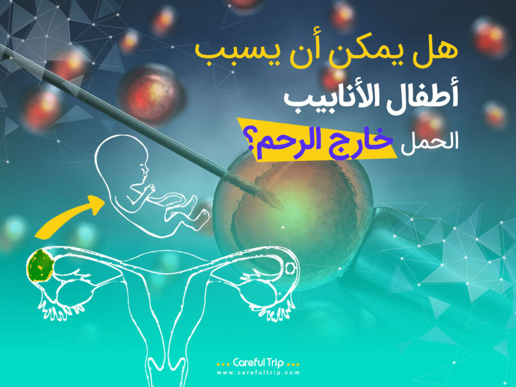 هل يمكن أن يسبب أطفال الأنابيب الحمل خارج الرحم؟
