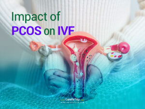 Impact of PCOS on IVF