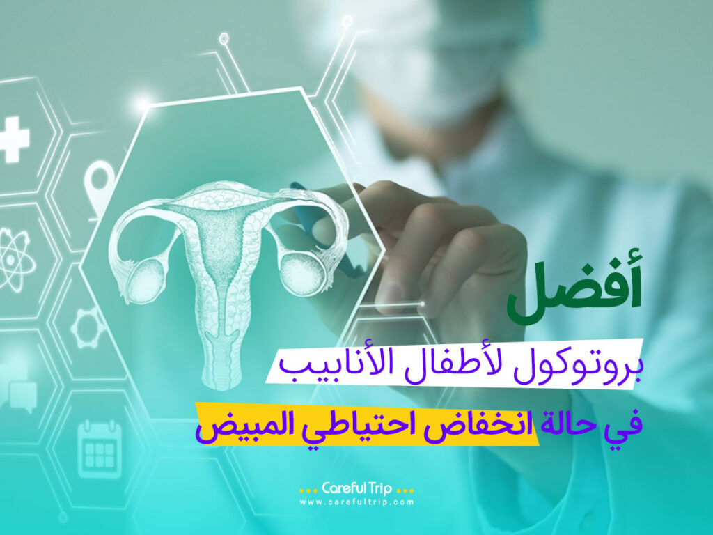 أفضل بروتوكول لأطفال الأنابيب في حالة انخفاض احتياطي المبيض