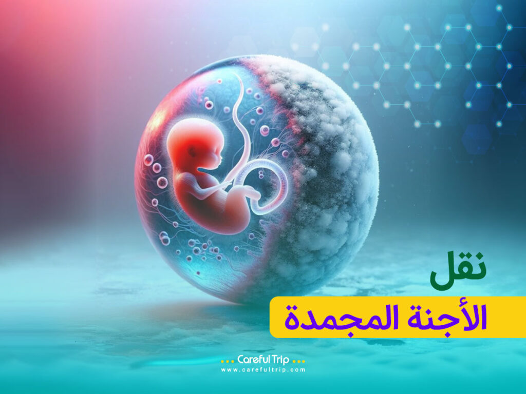 نقل الأجنة المجمدة