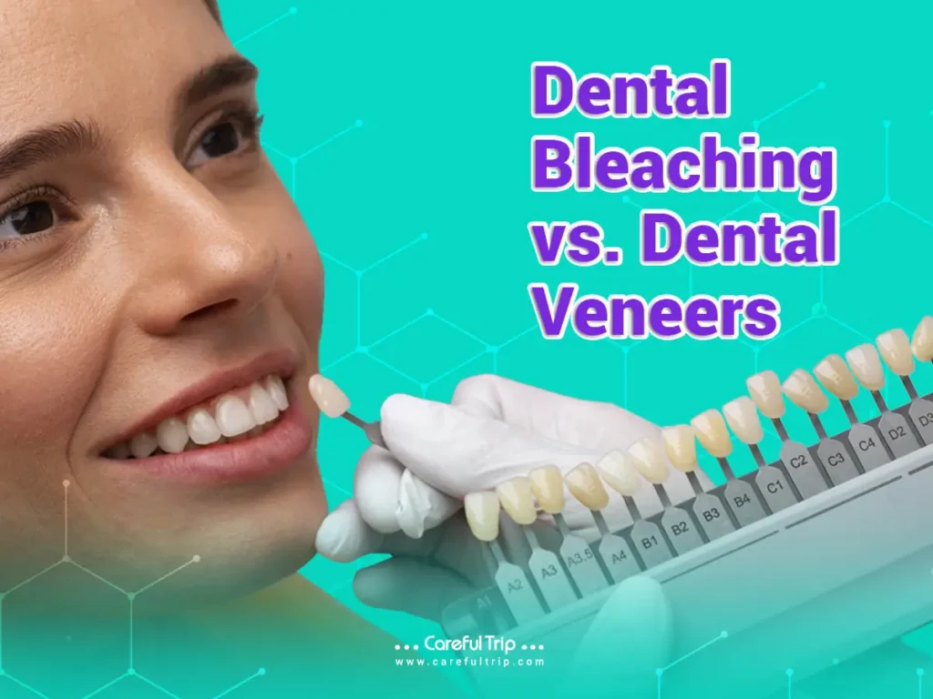 Dental Bleaching vs. Dental Veneers